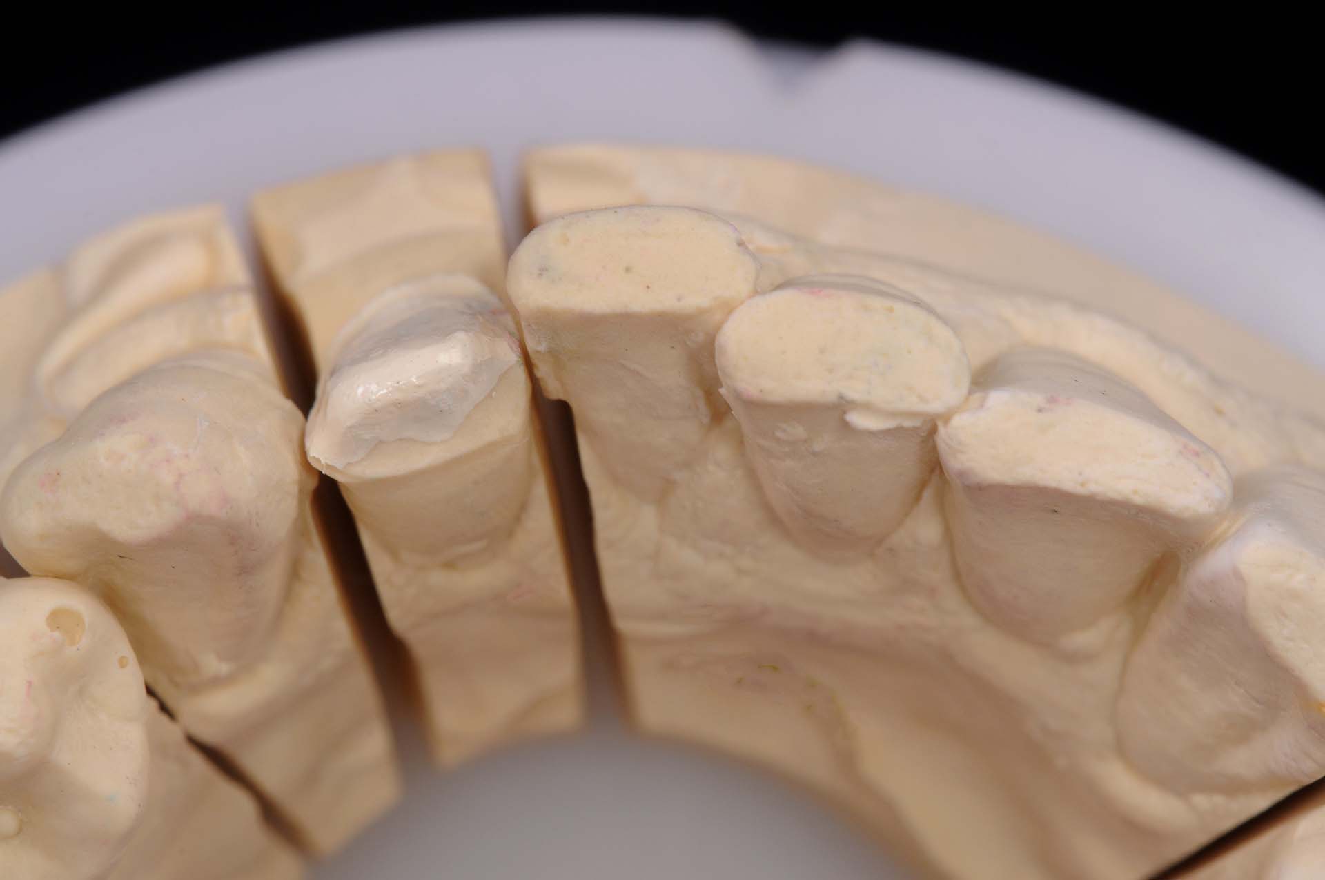 Veneer 32